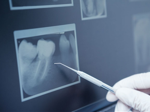 Digital X-Rays